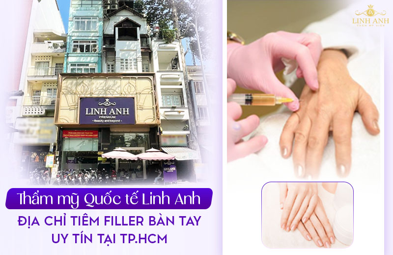 Địa chỉ tiêm filler bàn tay - Phòng khám Thẩm mỹ Linh Anh Địa chỉ tiêm filler bàn tay