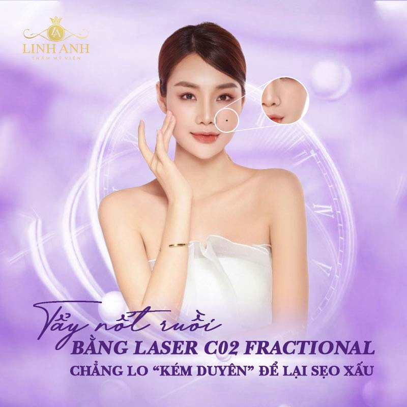 Dịch vụ tẩy nốt ruồi XẤU tại Linh Anh