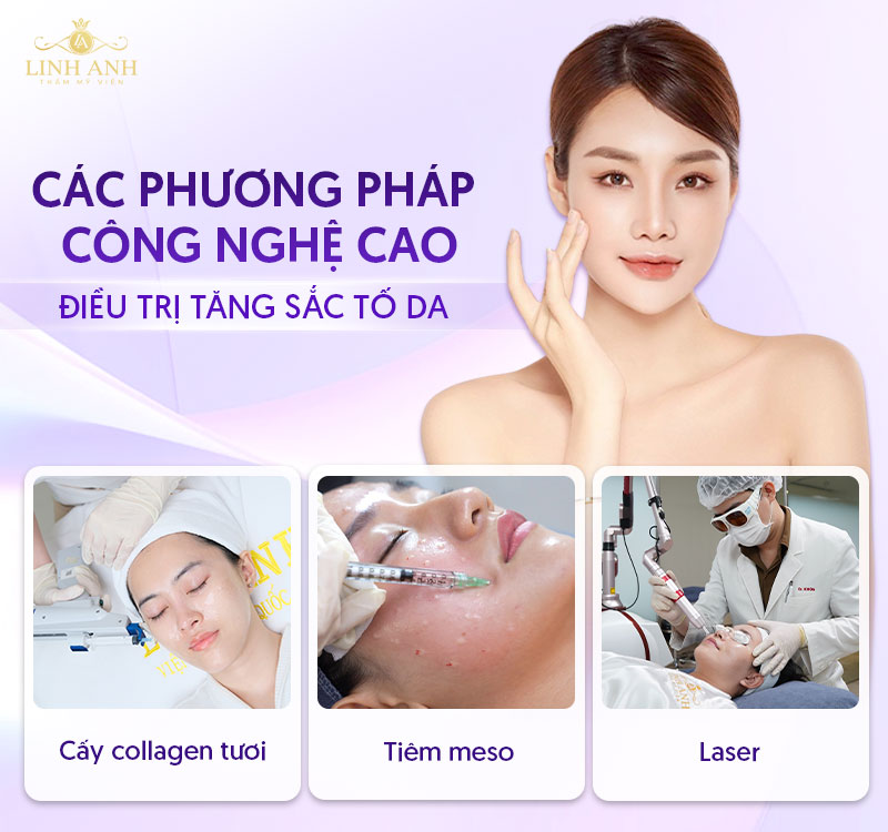 Điều trị tăng sắc tố da Điều trị tăng sắc tố da