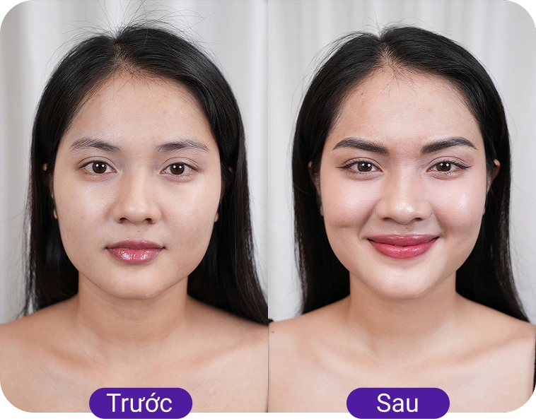 Chị Ngọc Bích (35 tuổi)