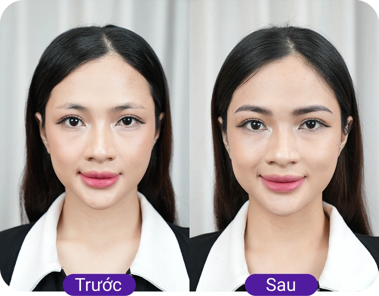 Chị Ánh Tuyết (28 tuổi)