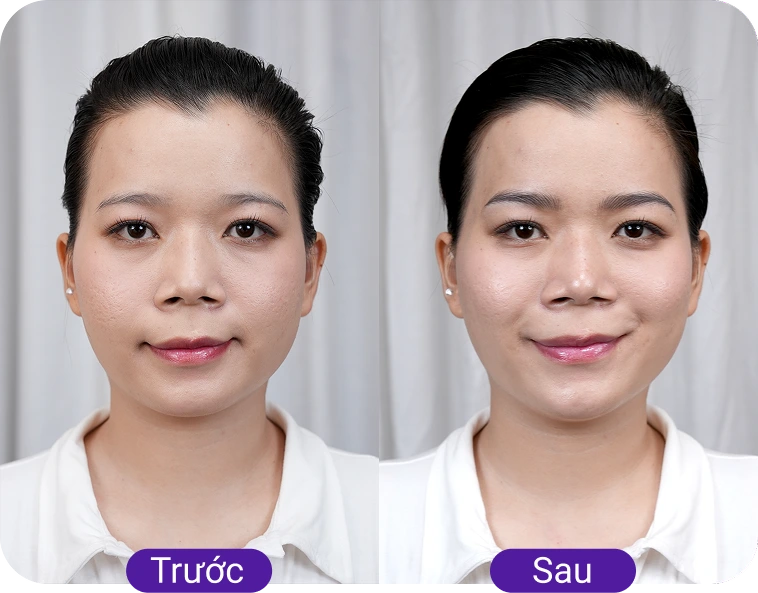 Chị Minh Anh (32 tuổi)