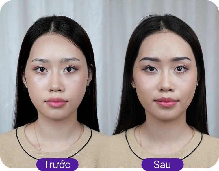 Chị Thanh Huyền (27 tuổi)