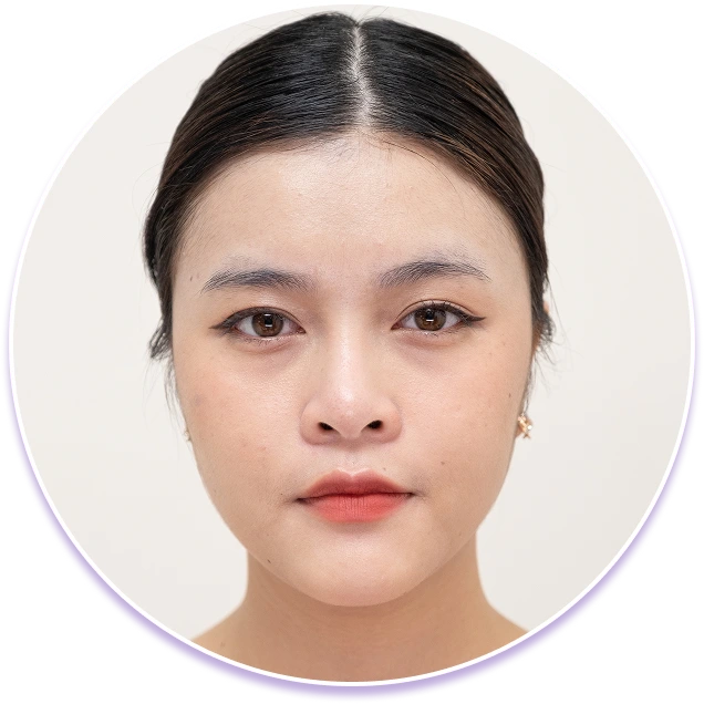 Lông mày mọc lộn xộn, mọc lệch hay mọc ngược