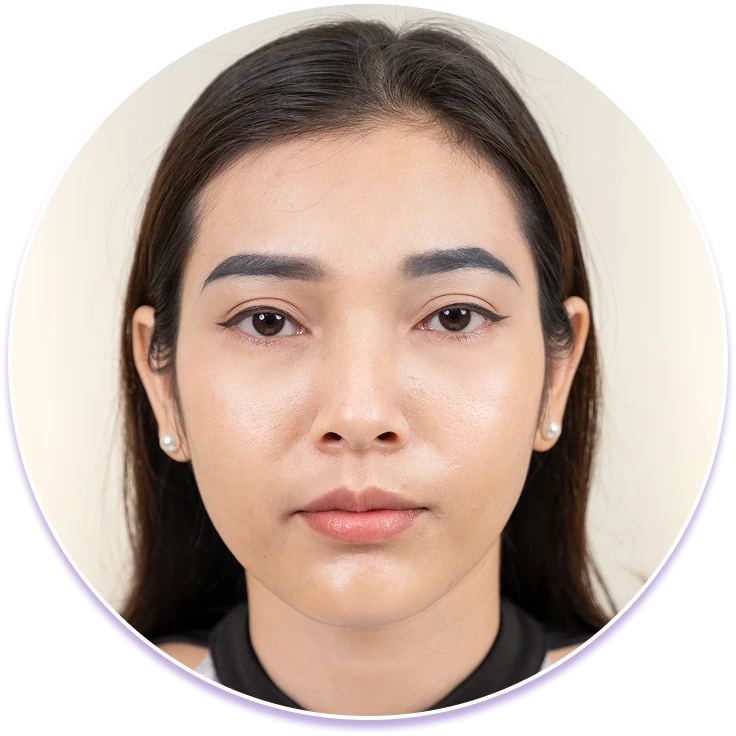 Lông mày từng phun xăm hỏng, trổ xanh - trổ đỏ