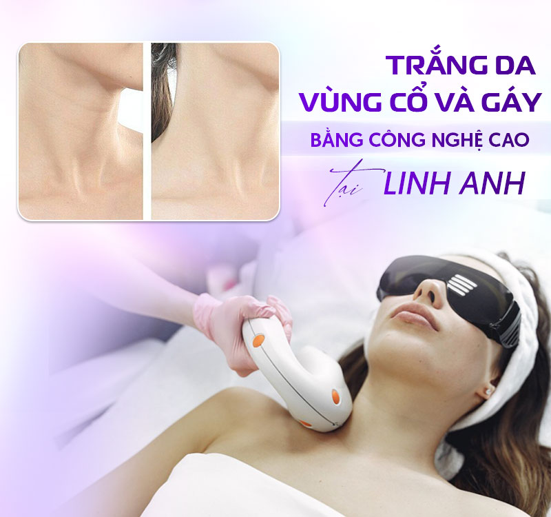 làm trắng da vùng cổ và gáy làm trắng da vùng cổ và gáy