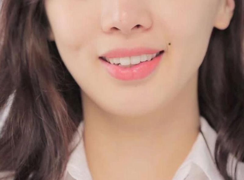 Người có nốt ruồi ở miệng