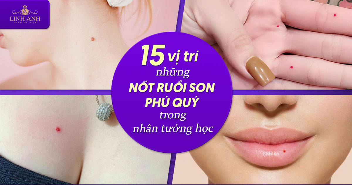Những nốt ruồi son phú quý giúp chủ nhân giàu sang, hậu vận sung túc