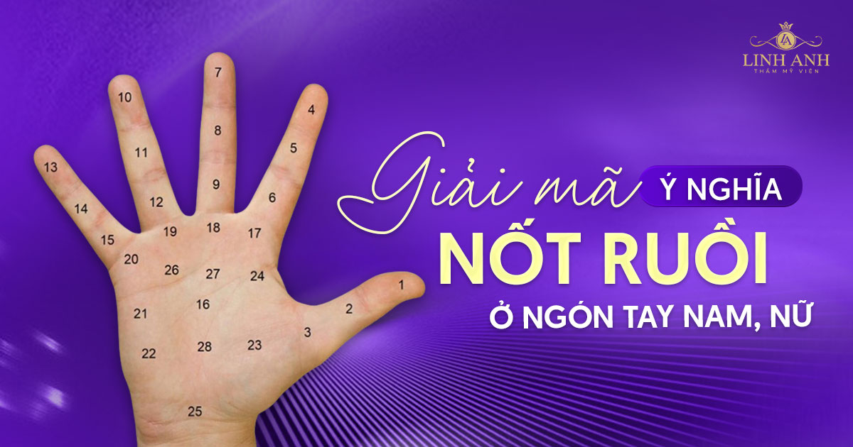 nốt ruồi ở ngón tay