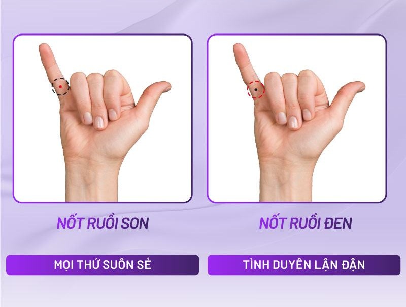 nốt ruồi trên ngón tay cái bên phải nốt ruồi trên ngón tay cái bên phải