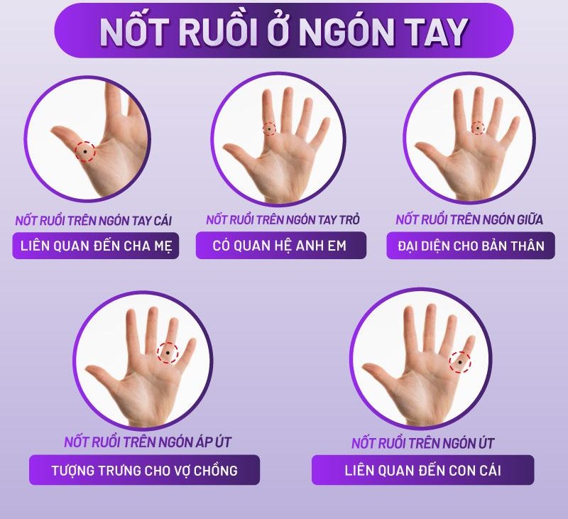 nốt ruồi trên ngón tay nốt ruồi trên ngón tay