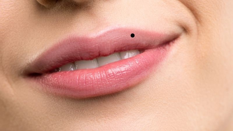 nốt ruồi vượng phu là gì nốt ruồi vượng phu là gì