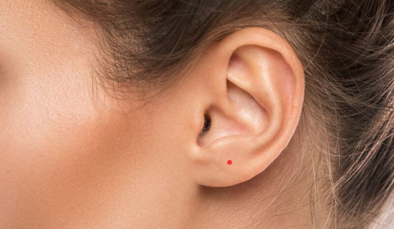 Nốt ruồi đỏ phú quý trên tai