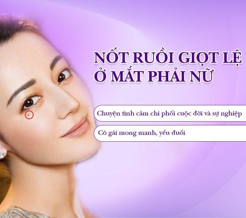 Nốt ruồi đón lệ bên phải nữ
