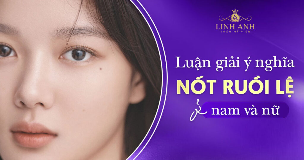Nốt ruồi lệ