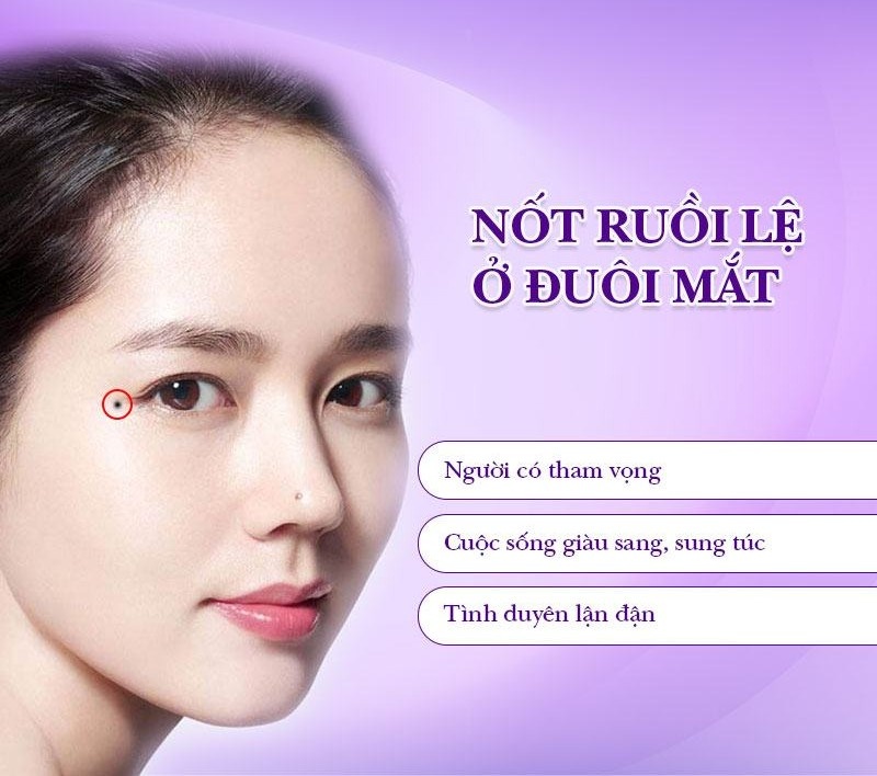 Nốt ruồi lệ ở đuôi mắt