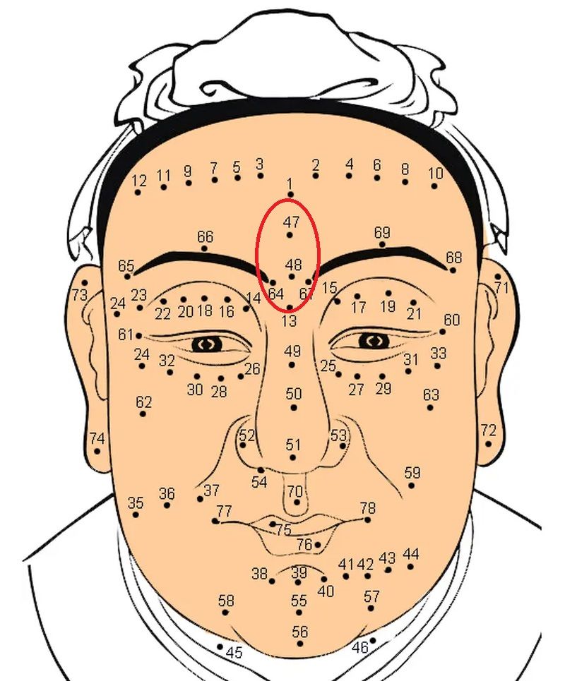 Nốt ruồi ở giữa trán
