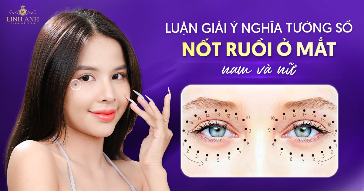 Nốt ruồi ở mắt