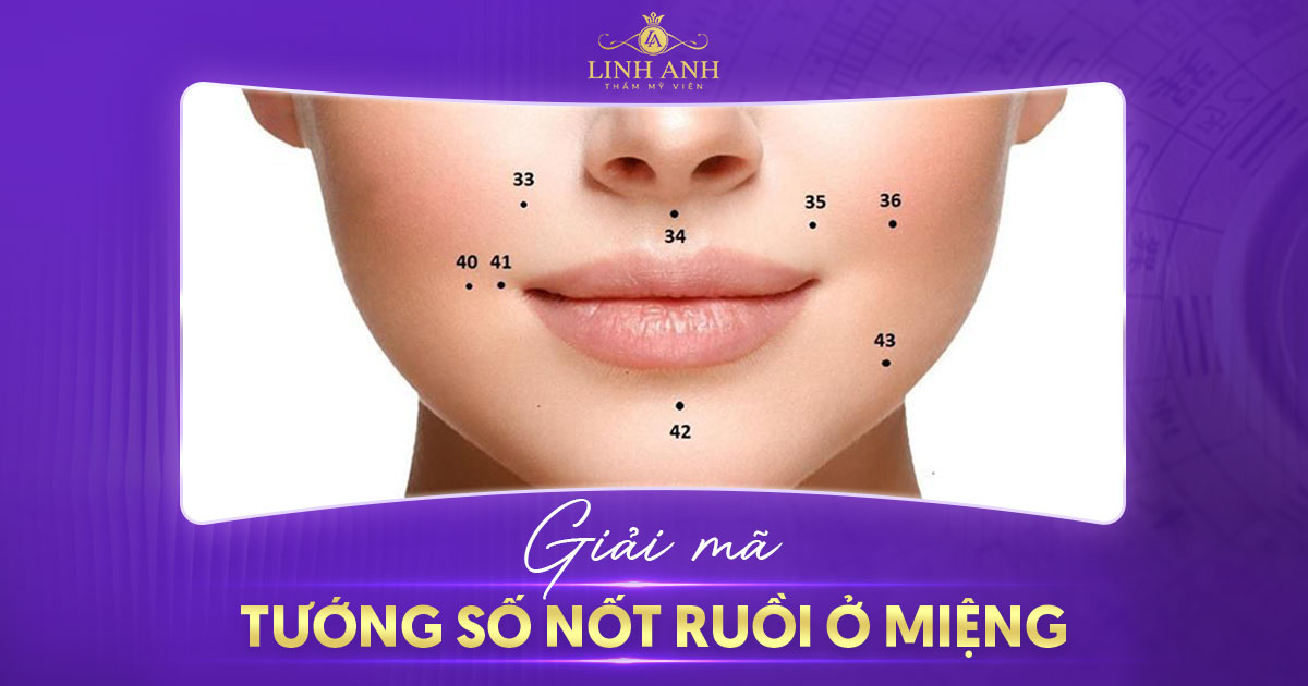 Nốt ruồi ở miệng