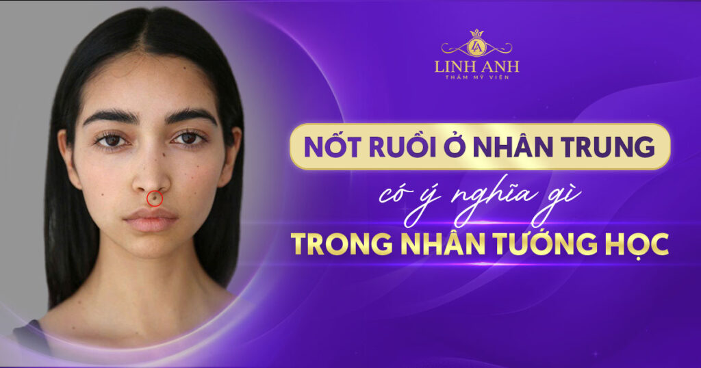 Nốt ruồi ở nhân trung