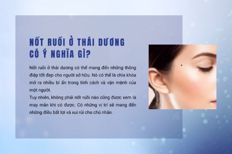 Nốt ruồi ở thái dương có ý nghĩa gì