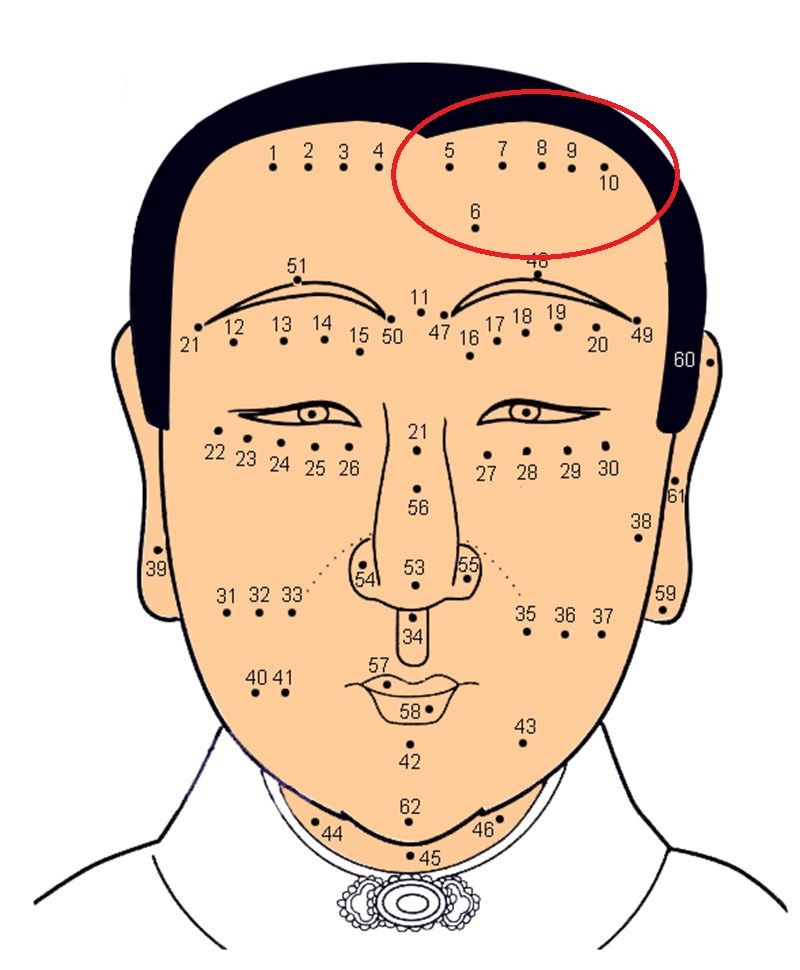 Nốt ruồi ở trán nữ