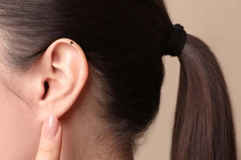 Nốt ruồi ở vành tai trái phụ nữ Nốt ruồi ở vành tai trái phụ nữ