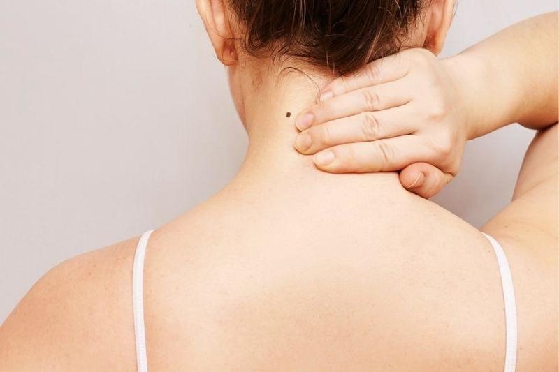 Nốt ruồi sau lưng gần gáy