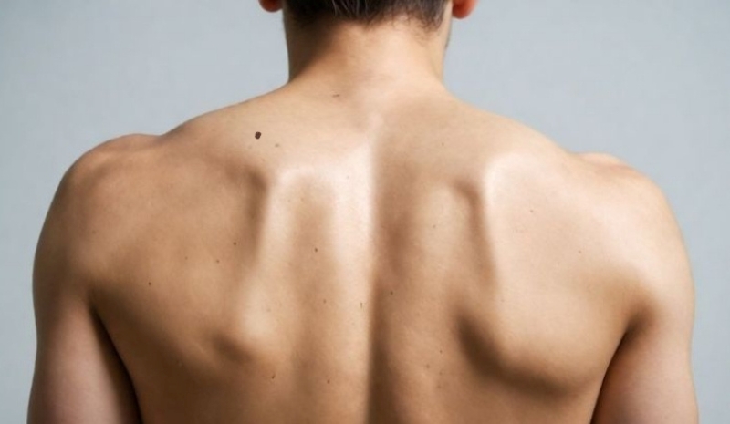 Nốt ruồi sau lưng đàn ông bên trái