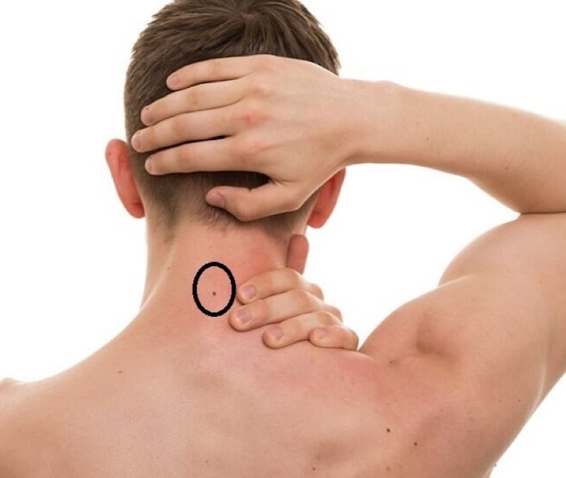 Nốt ruồi sau lưng gần gáy