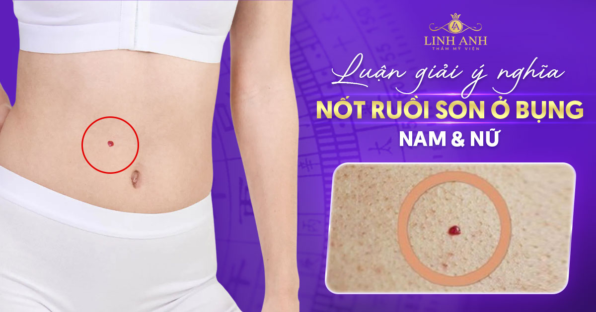 Luận giải ý nghĩa nốt ruồi son ở bụng nam, nữ chi tiết nhất