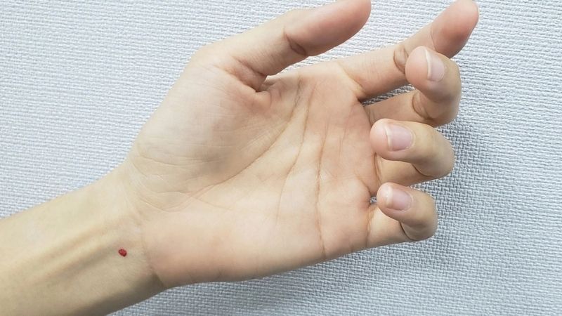 Nốt ruồi son ở cằm phụ nữ
