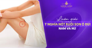 Nốt ruồi son ở đùi