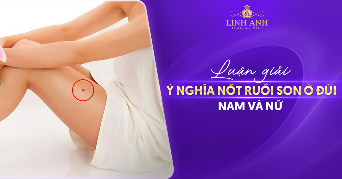 Khám phá vận mệnh qua nốt ruồi son ở đùi – Tình duyên, tài lộc, sự nghiệp