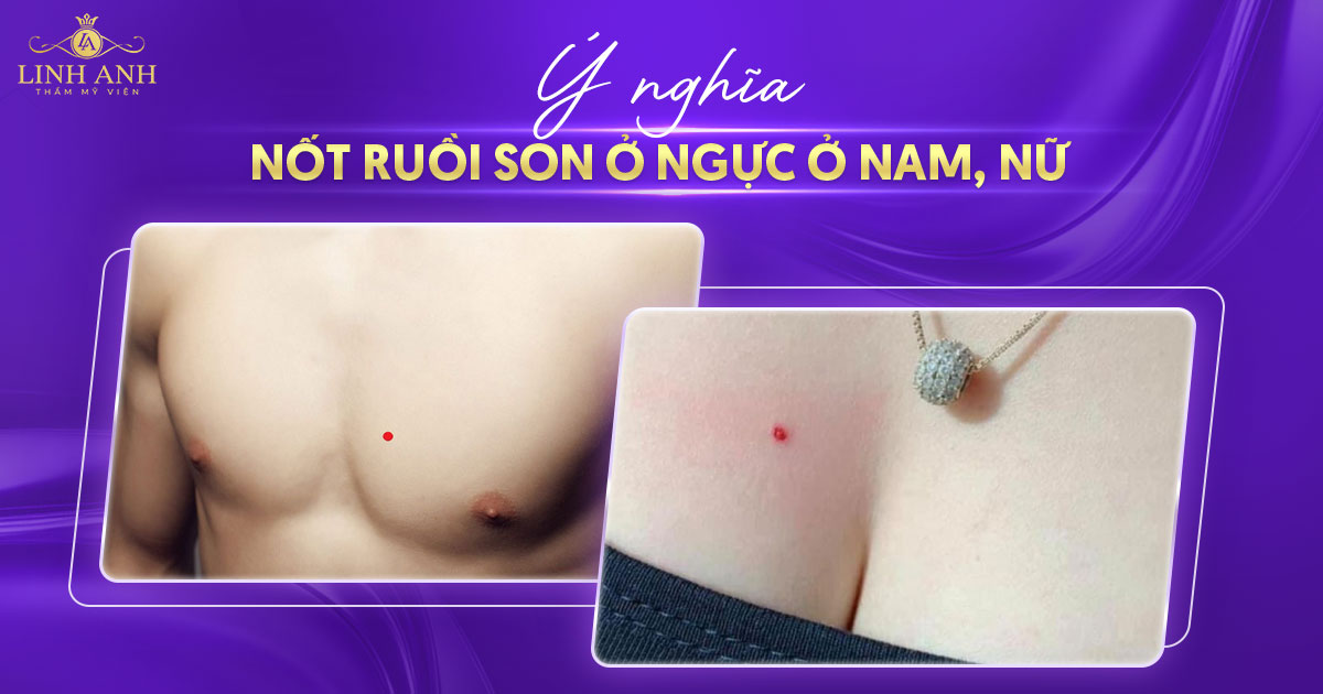 Ý nghĩa nốt ruồi son ở ngực của nam nữ trong nhân tướng học