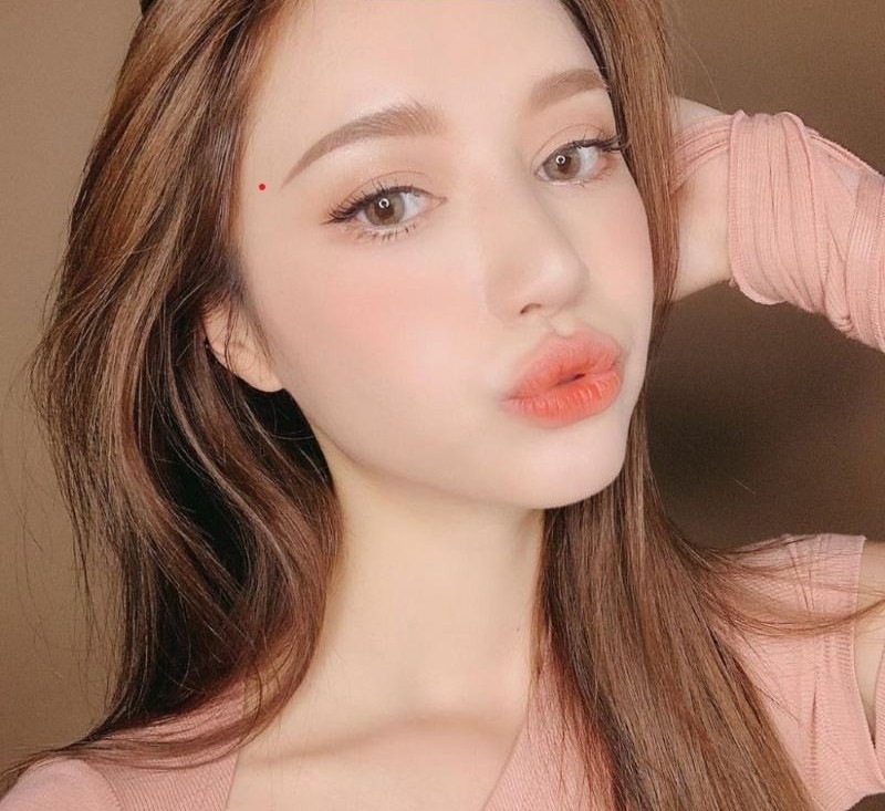 Nốt ruồi son ở thái dương Nốt ruồi son ở thái dương
