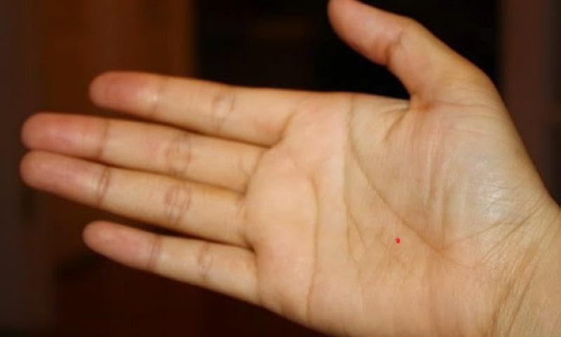 Nốt ruồi son trong lòng bàn tay phải nữ