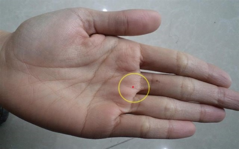 Nốt ruồi son trong lòng bàn tay trái nam