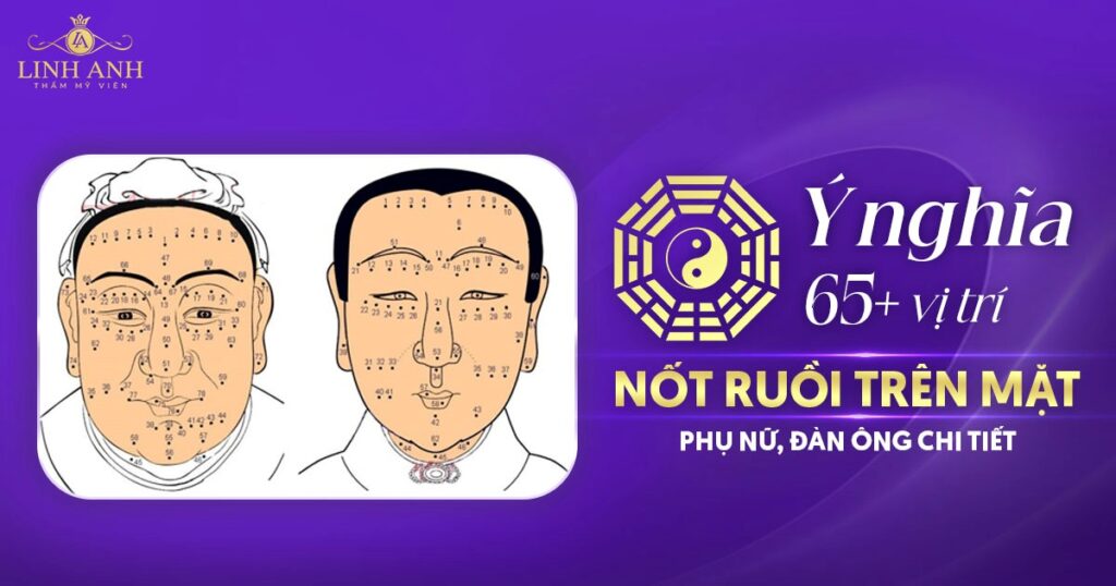 Nốt ruồi trên mặt