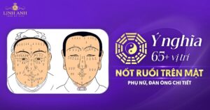 Nốt ruồi trên mặt