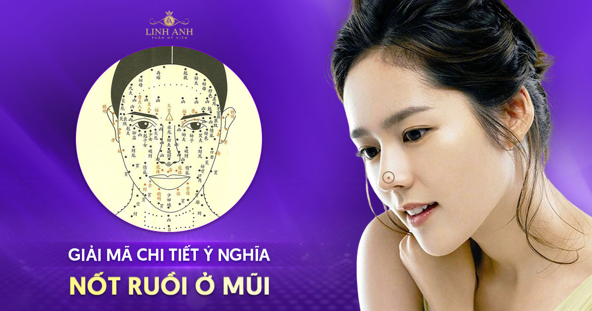 Nốt ruồi trên mũi