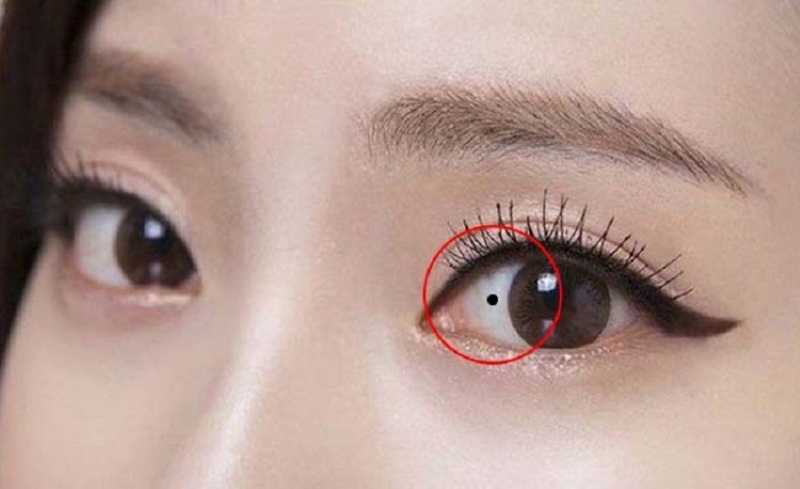 Nốt ruồi trong mắt phải Nữ