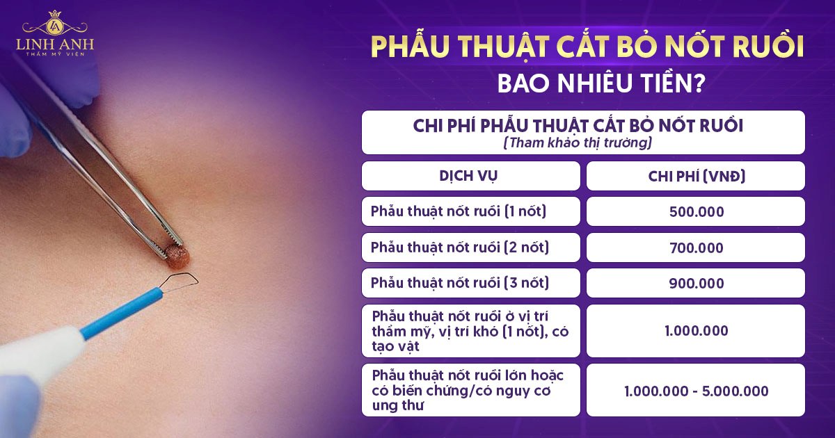 Phẫu thuật cắt bỏ nốt ruồi bao nhiêu tiền