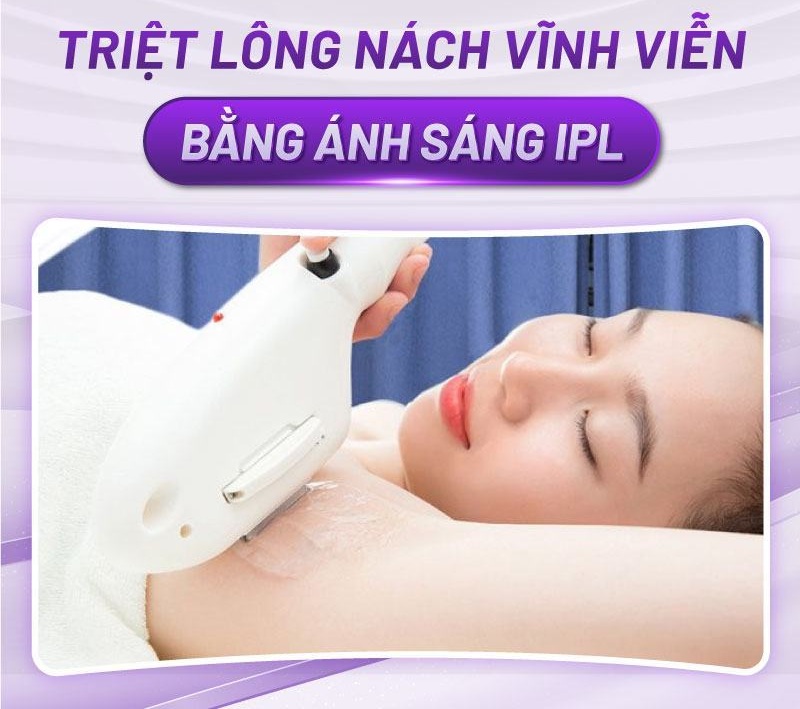 phương pháp triệt lông nách phương pháp triệt lông nách