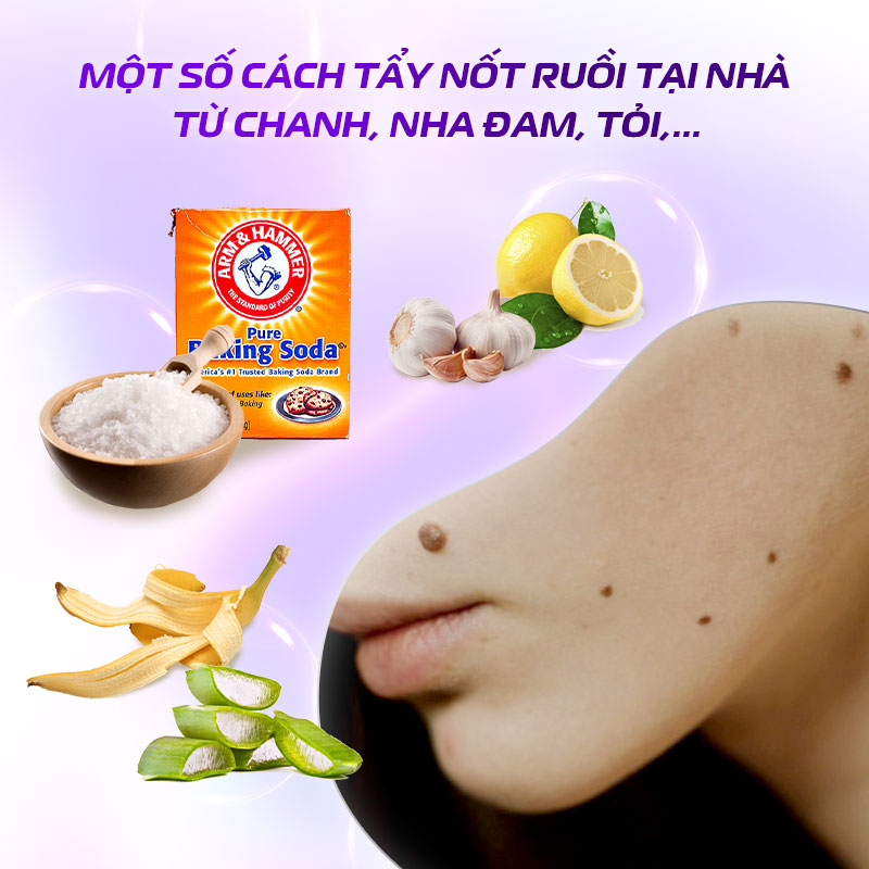Phương pháp xóa nốt ruồi tự nhiên tại nhà