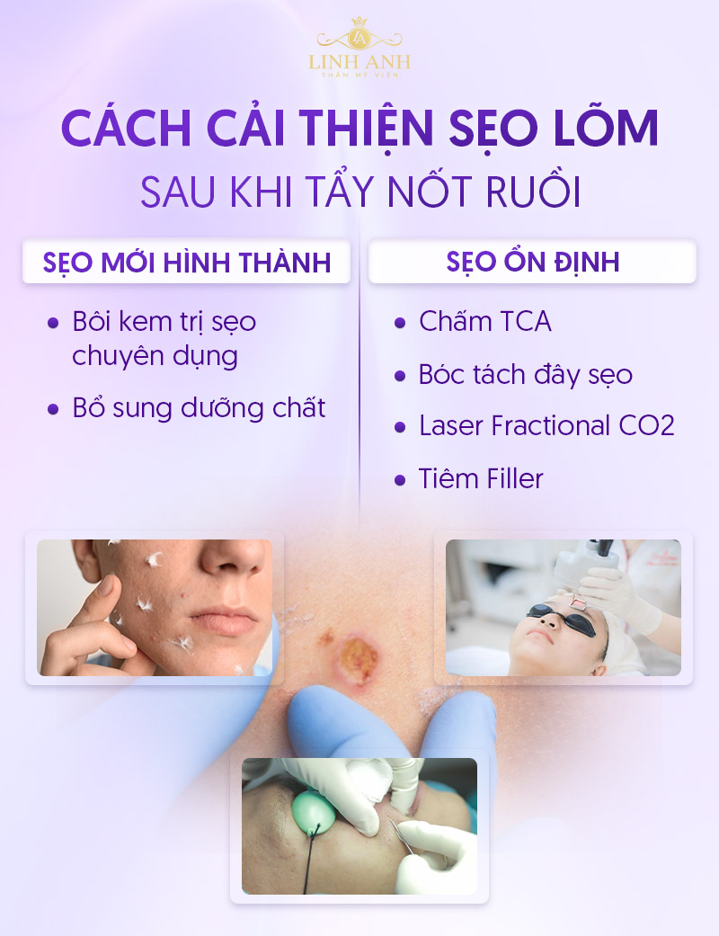 Sau tẩy nốt ruồi bị sẹo lõm phải làm sao