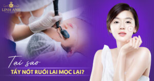 Tại sao tẩy nốt ruồi lại mọc lại