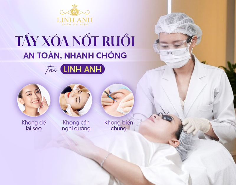 Tẩy nốt ruồi bằng công nghệ laser Fractional CO2 Tẩy nốt ruồi bằng công nghệ laser Fractional CO2