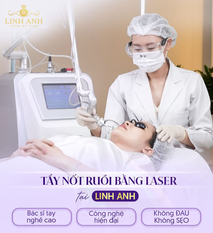 Tẩy nốt ruồi bằng laser an toàn tại Linh Anh