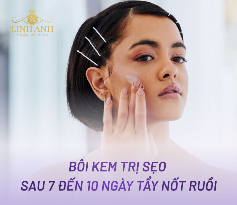Tẩy nốt ruồi bao lâu thì bôi kem trị sẹo